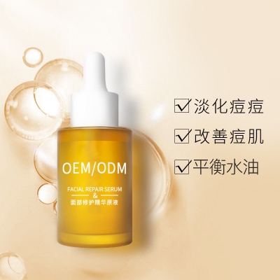 淮北市_祛痘精华原液OEM